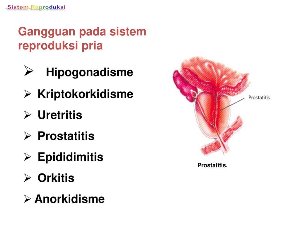 Adalah gangguan pada radang kesehatan berupa pada prostatitis pria reproduksi 10 Penyakit