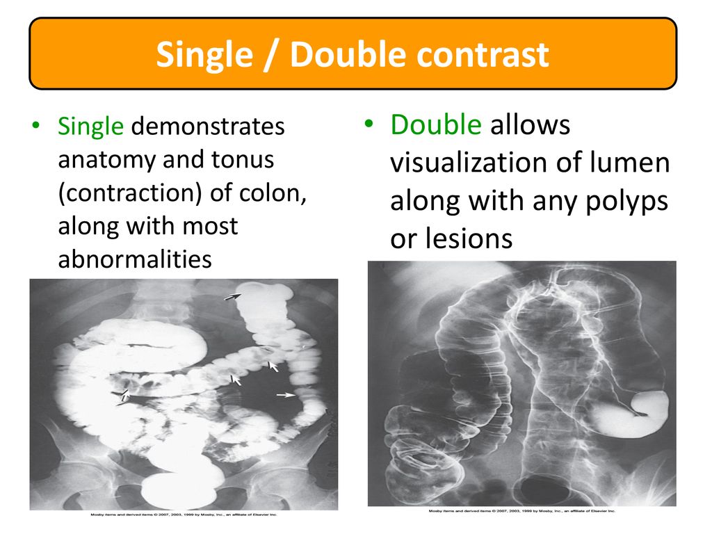 Single double. Смесь Double contrast.