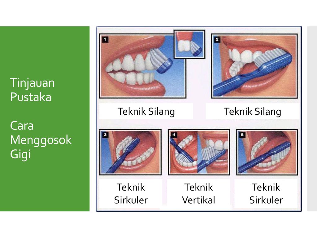 Pengaruh Cara Menggosok Gigi Dengan Pengikisan Enamel Gigi Ppt Download