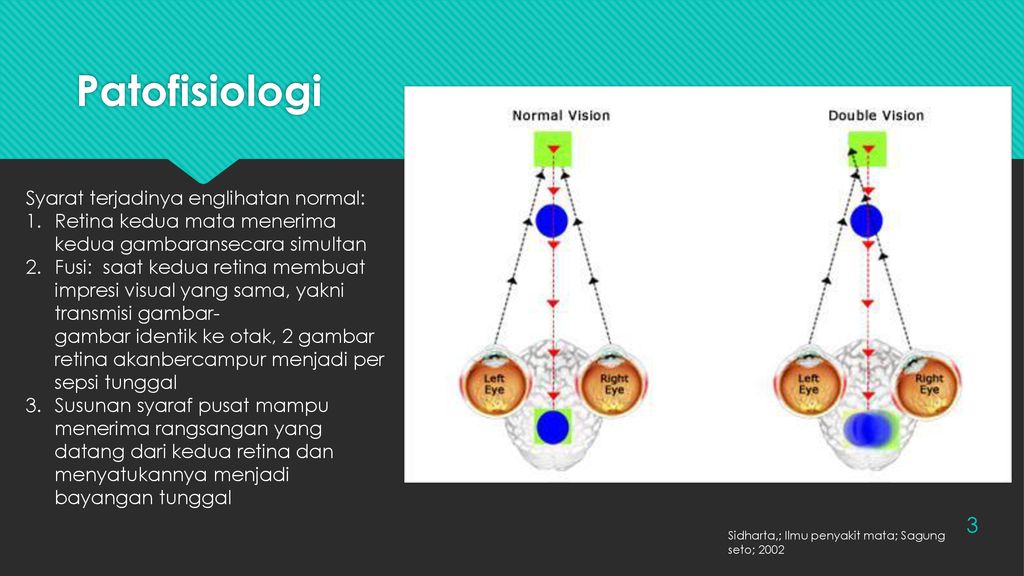 Oleh: Nanda Febry Pembimbing : dr. Indri Lakhsmi Putri Sp BP-RE (KKF ...