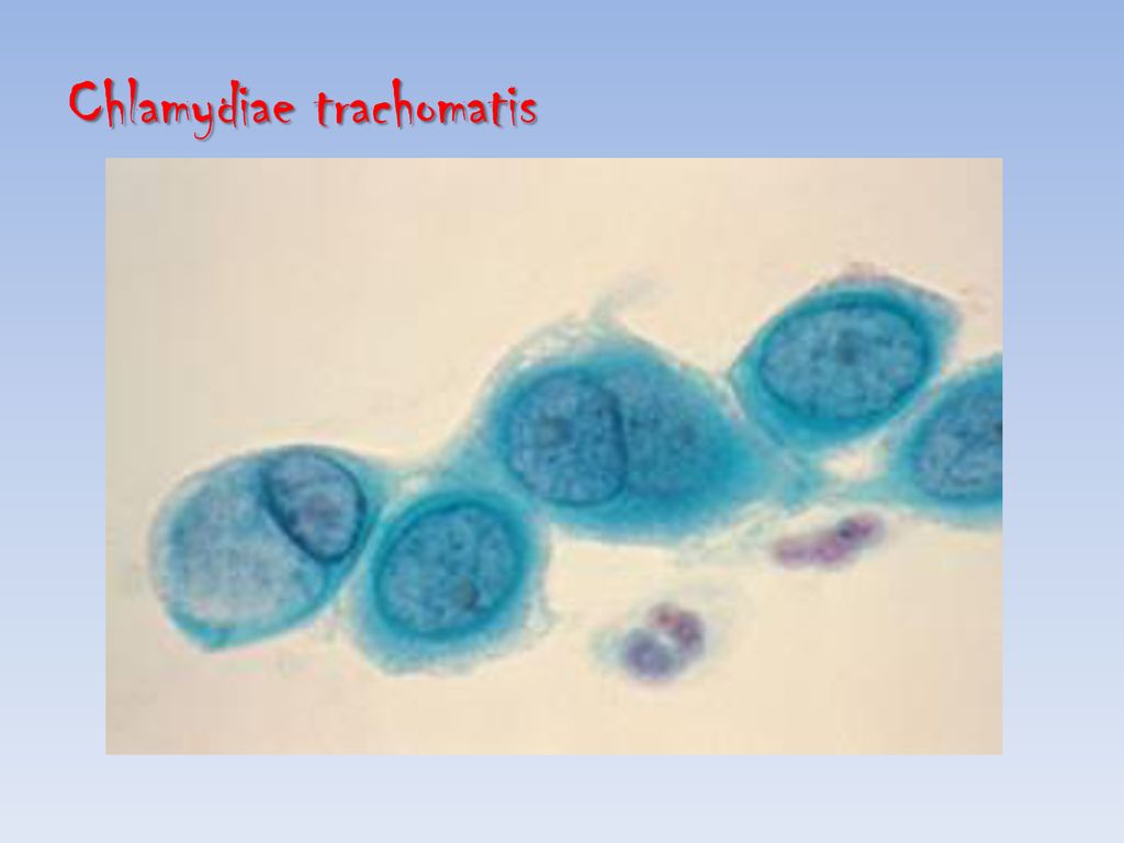 Хламидия вылечивается. Хламидии 10/6. Урогенитальный хламидиоз возбудитель. Хламидии заболевания у человека.