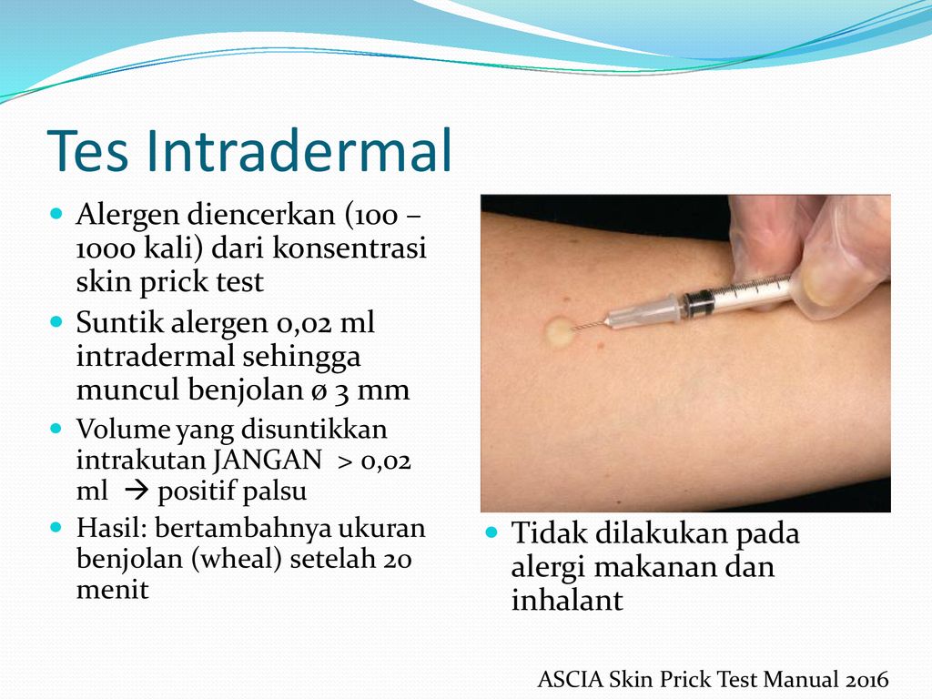 Prosedur Diagnostik Penyakit Alergi Imunologi Ppt Download