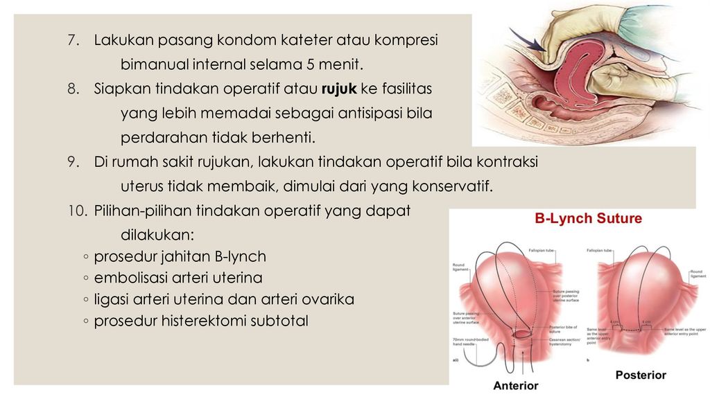 varicoza i artera uterina)