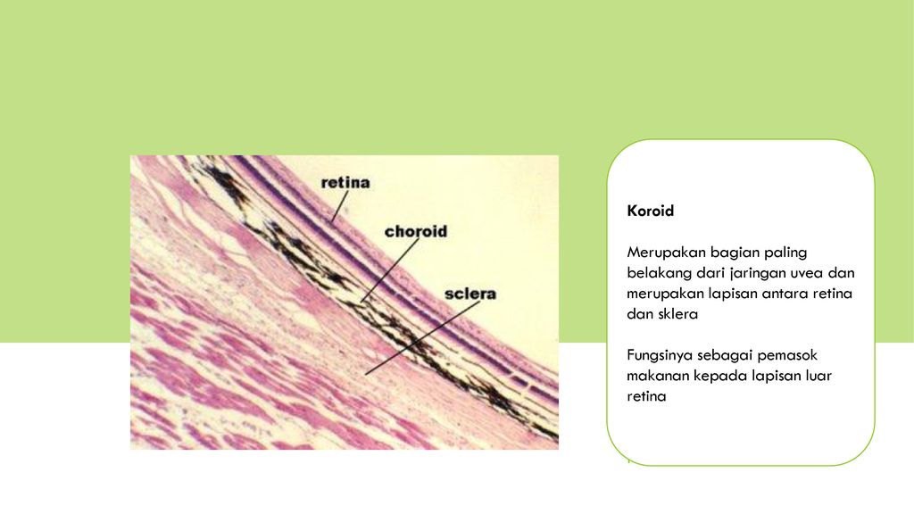UVEA Koroid. Merupakan bagian paling belakang dari jaringan uvea dan merupakan lapisan antara retina dan sklera.