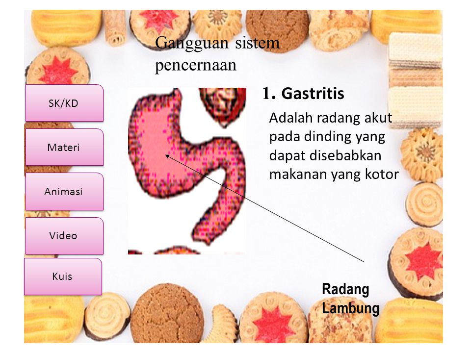 1. Gastritis Gangguan sistem pencernaan