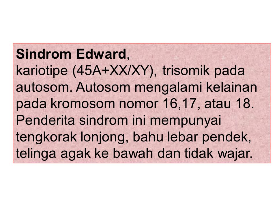 Sindrom Edward,