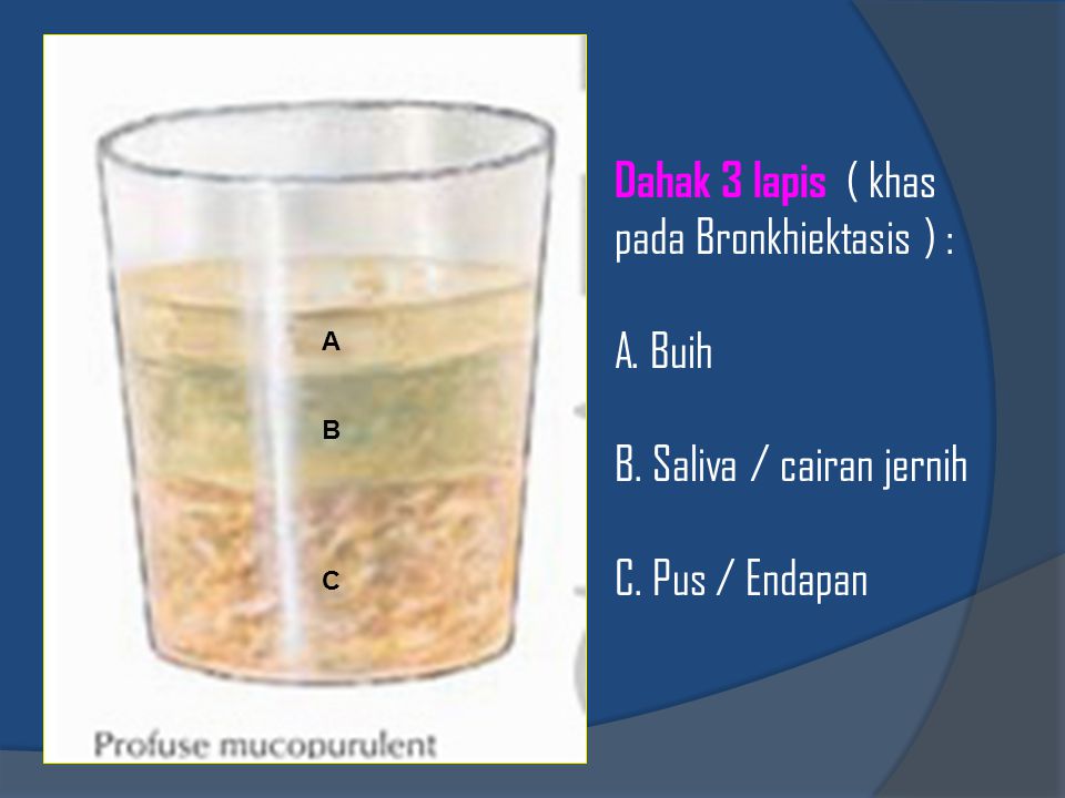 Dahak 3 lapis ( khas pada Bronkhiektasis ) :