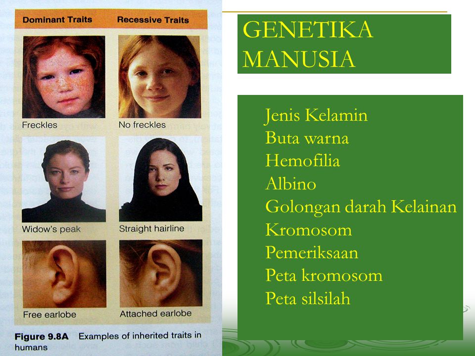 GENETIKA MANUSIA Jenis Kelamin Buta warna Hemofilia Albino Golongan darah Kelainan Kromosom Pemeriksaan Peta kromosom Peta silsilah.