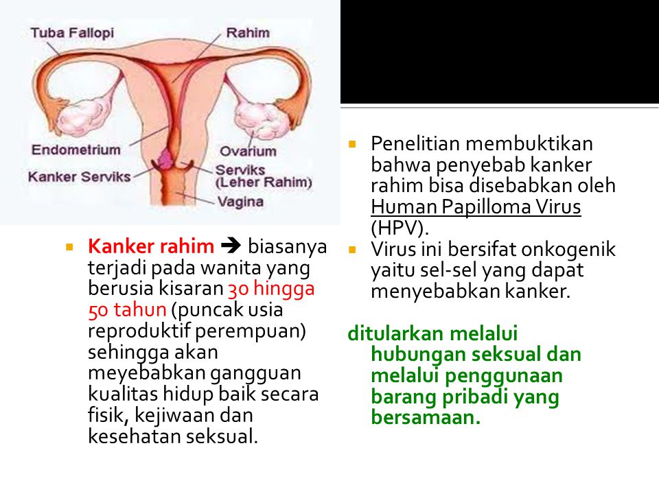 Penelitian membuktikan bahwa penyebab kanker rahim bisa disebabkan oleh Human Papilloma Virus (HPV).