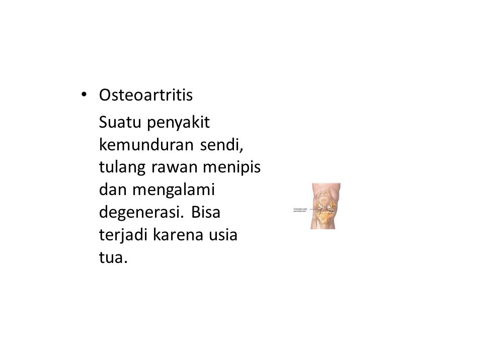 Osteoartritis Suatu penyakit kemunduran sendi, tulang rawan menipis dan mengalami degenerasi.