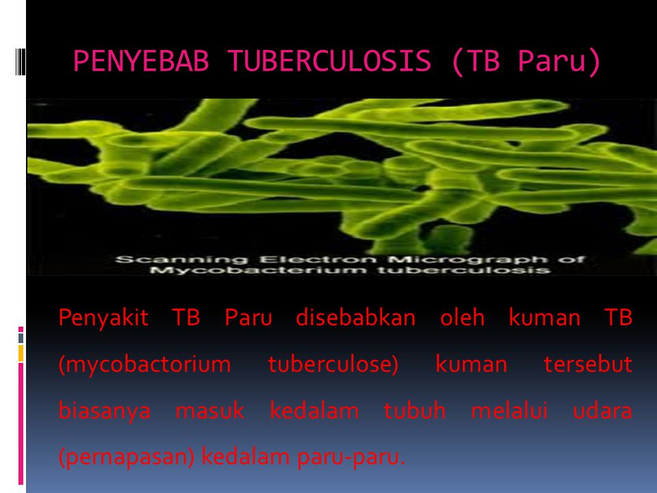 PENYEBAB TUBERCULOSIS (TB Paru)