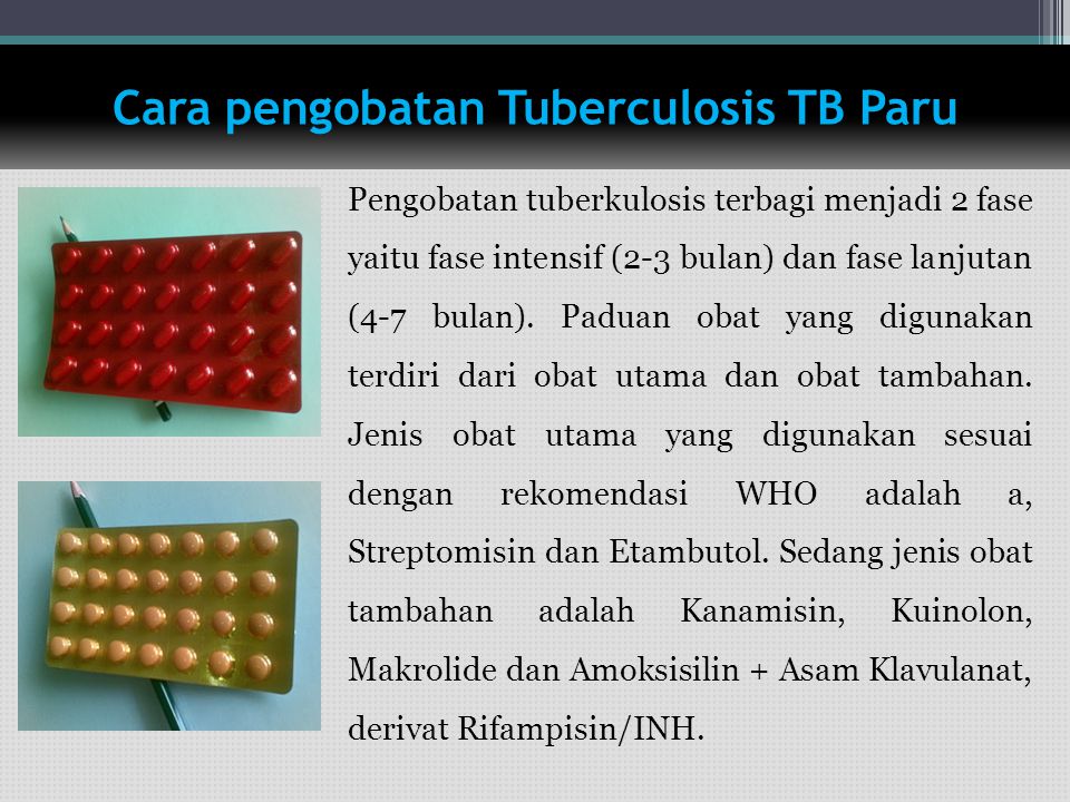 Cara pengobatan Tuberculosis TB Paru