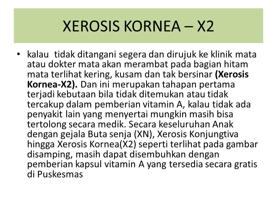 XEROSIS KORNEA – X2