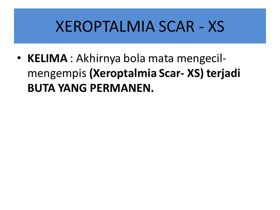 XEROPTALMIA SCAR - XS KELIMA : Akhirnya bola mata mengecil-mengempis (Xeroptalmia Scar- XS) terjadi BUTA YANG PERMANEN.
