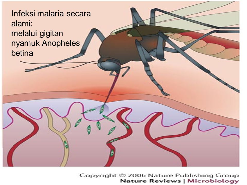 Тиф малярия. Малярия рисунок.