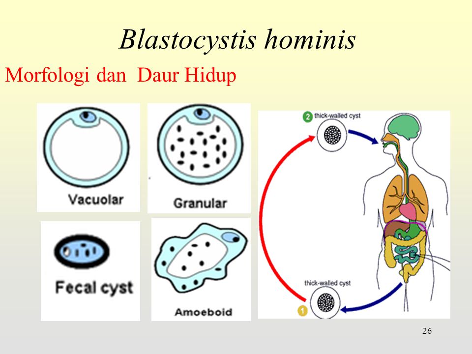 parazit blastocystis hominis pastile parazite galbene