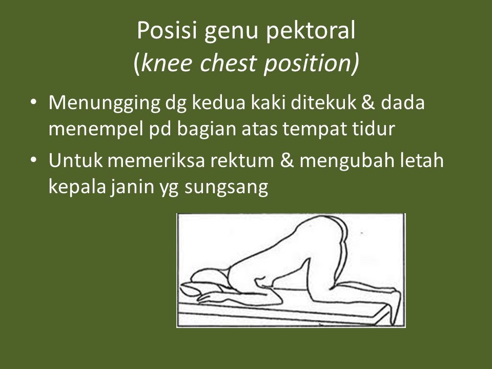 Posisi genu pektoral (knee chest position)