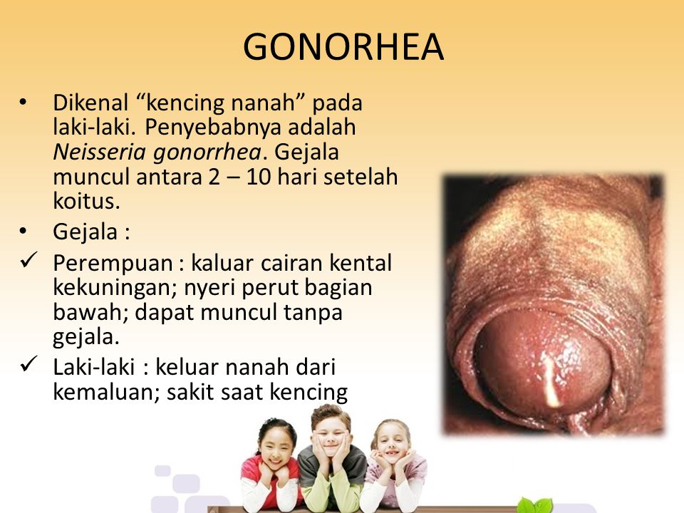 GONORHEA Dikenal kencing nanah pada laki-laki. Penyebabnya adalah Neisseria gonorrhea. Gejala muncul antara 2 – 10 hari setelah koitus.