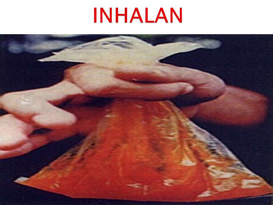 INHALAN