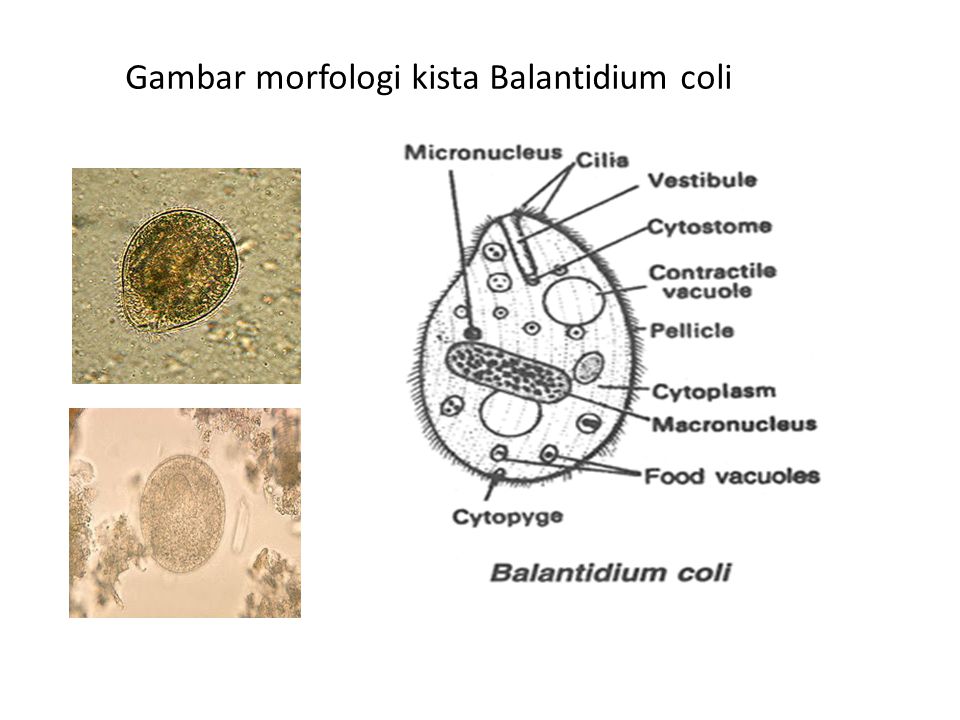 morfologia giardiozei