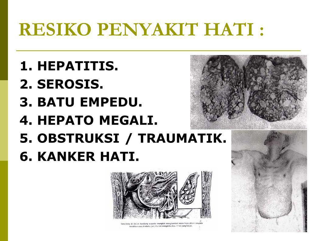 RESIKO PENYAKIT HATI : 1. HEPATITIS. 2. SEROSIS. 3. BATU EMPEDU.