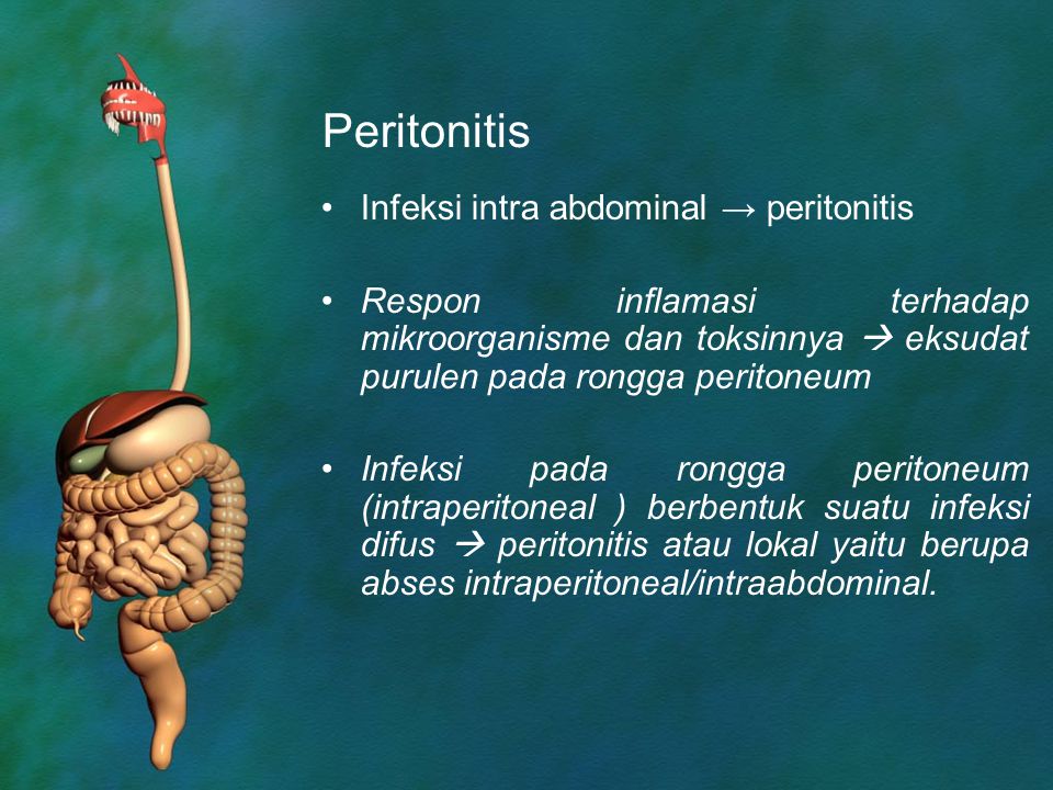 Adalah peritonitis Peritonitis Adalah?