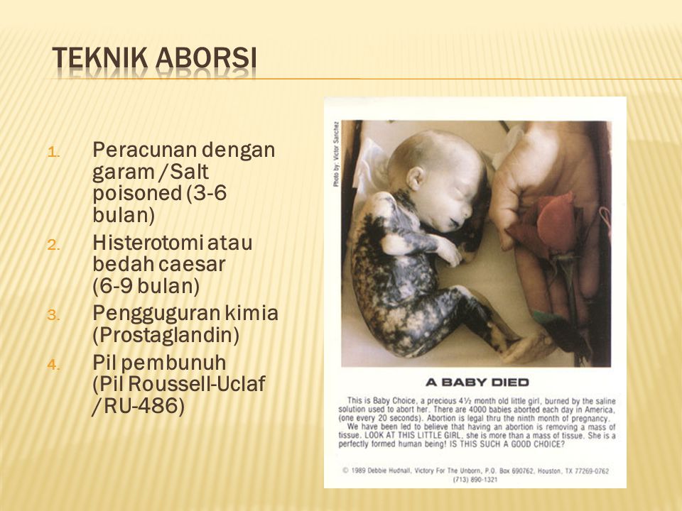 TEKNIK ABORSI Peracunan dengan garam /Salt poisoned (3-6 bulan)