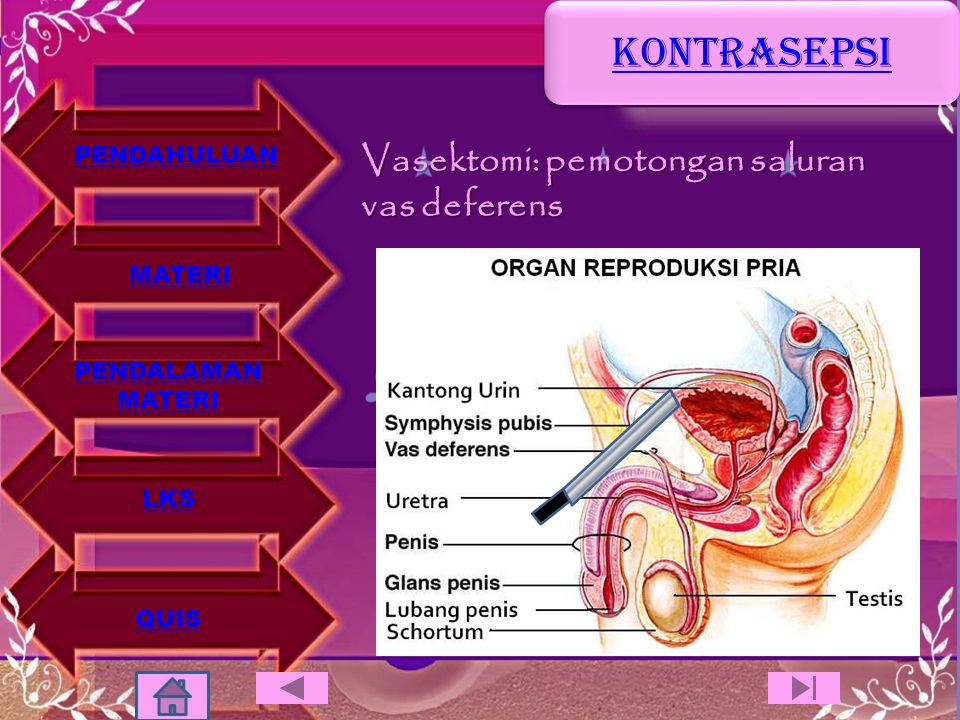 KONTRASEPSI Vasektomi: pemotongan saluran vas deferens PENDAHULUAN