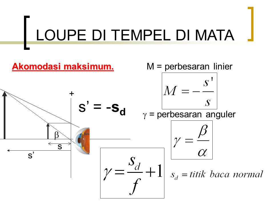 LOUPE DI TEMPEL DI MATA s’ = -sd Akomodasi maksimum.
