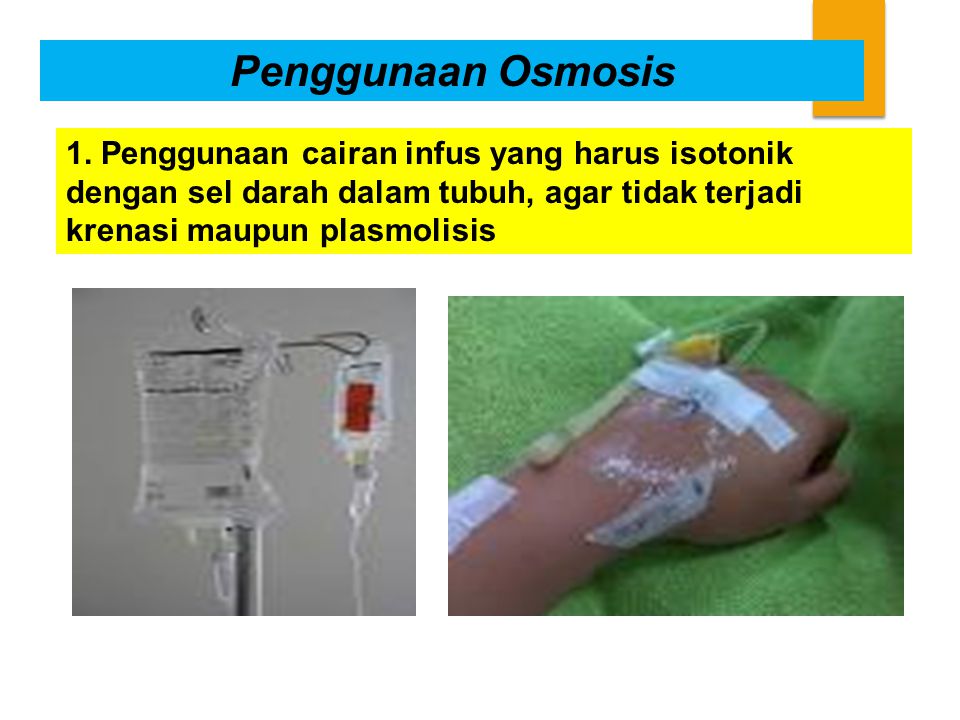 Penggunaan Osmosis 1.
