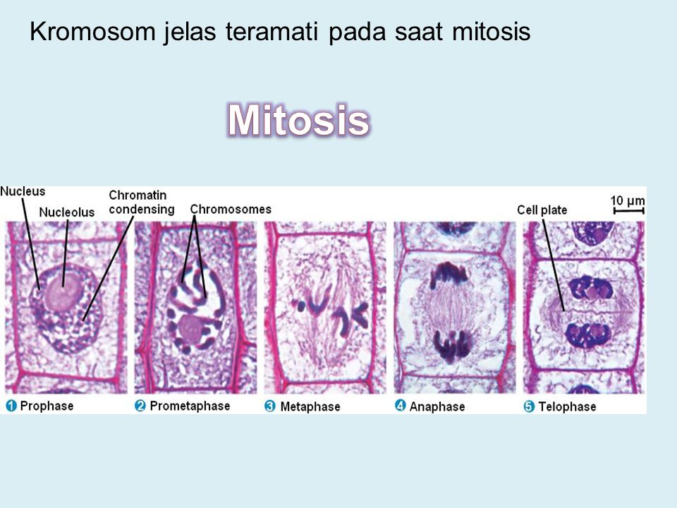 Kromosom jelas teramati pada saat mitosis