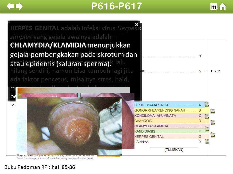 P616-P617 m. 100% CHLAMYDIA/KLAMIDIA menunjukkan gejala pembengkakan pada skrotum dan atau epidemis (saluran sperma).