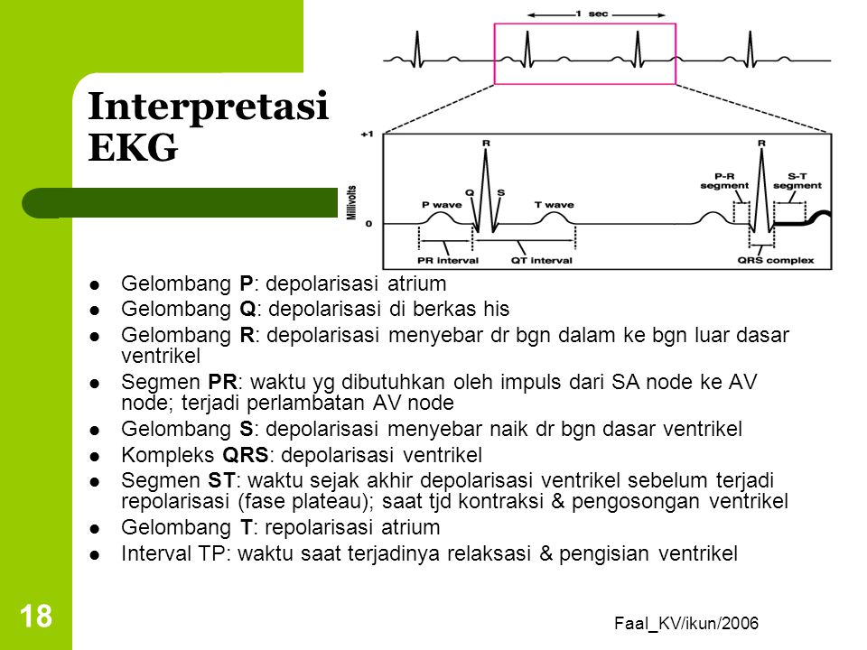 Interpretasi EKG Gelombang P: depolarisasi atrium
