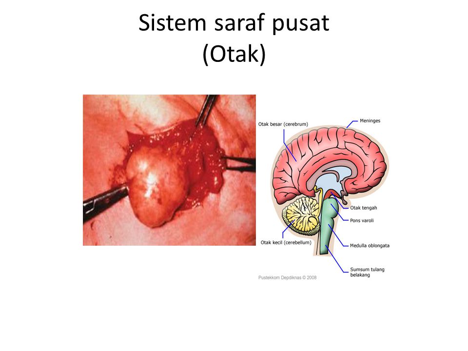 Sistem saraf pusat (Otak)