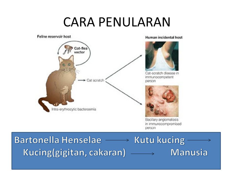 CARA PENULARAN Bartonella Henselae Kutu kucing Kucing(gigitan, cakaran) Manusia.