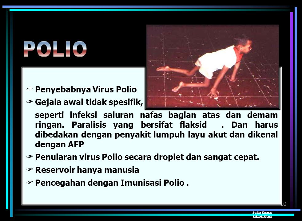 POLIO Penyebabnya Virus Polio Gejala awal tidak spesifik,
