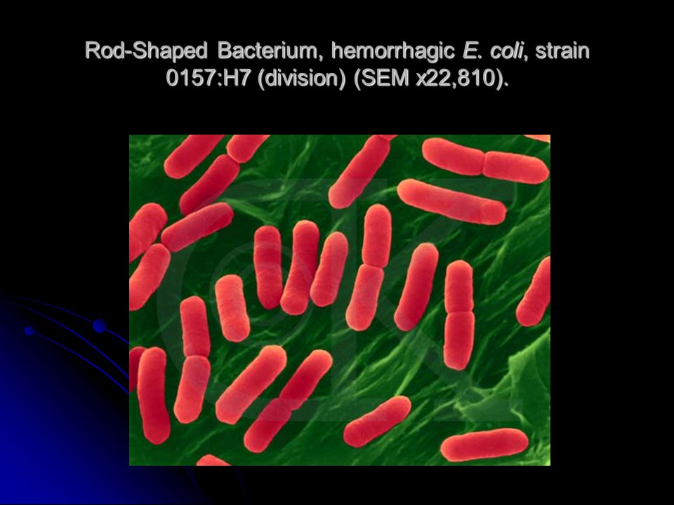 Rod-Shaped Bacterium, hemorrhagic E
