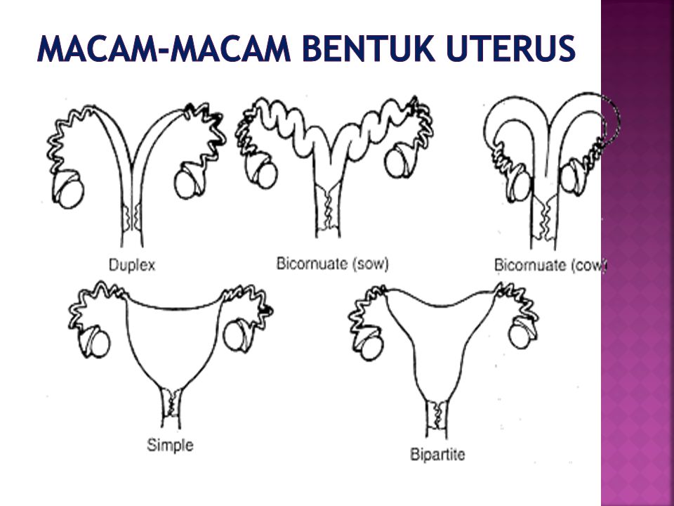 Macam-macam bentuk uterus