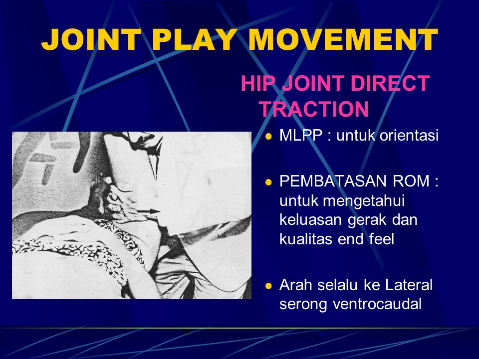 JOINT PLAY MOVEMENT HIP JOINT DIRECT TRACTION MLPP : untuk orientasi