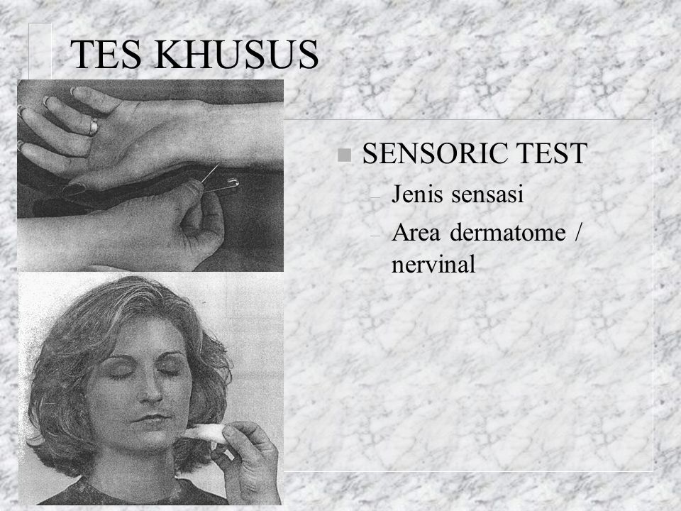 TES KHUSUS SENSORIC TEST Jenis sensasi Area dermatome / nervinal
