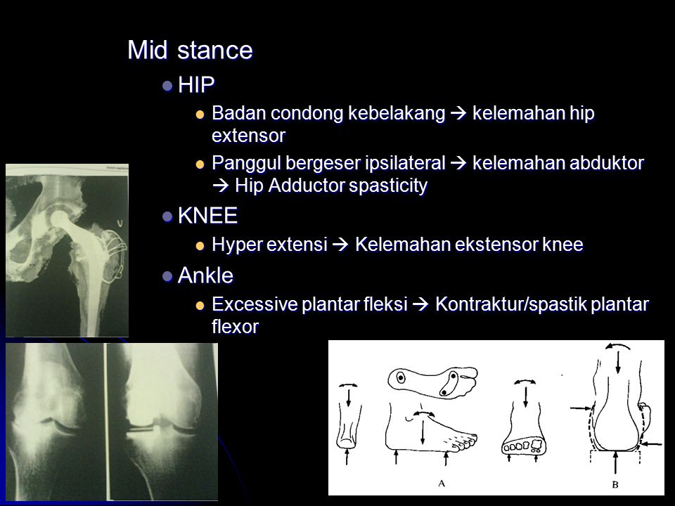 Mid stance HIP KNEE Ankle