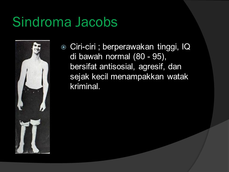 Sindroma Jacobs