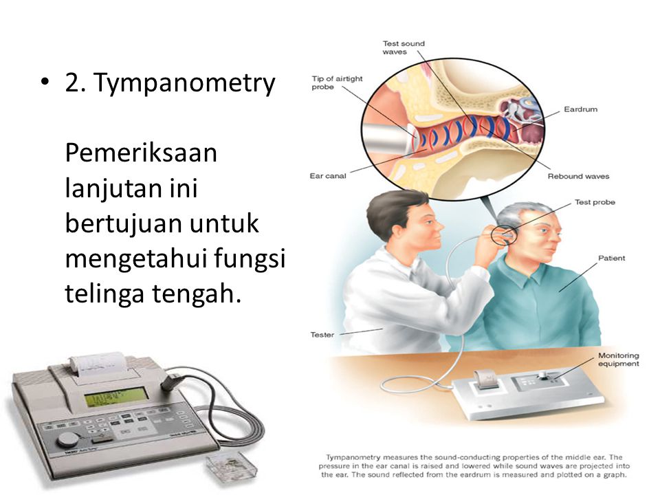 2. Tympanometry Pemeriksaan lanjutan ini bertujuan untuk mengetahui fungsi telinga tengah.