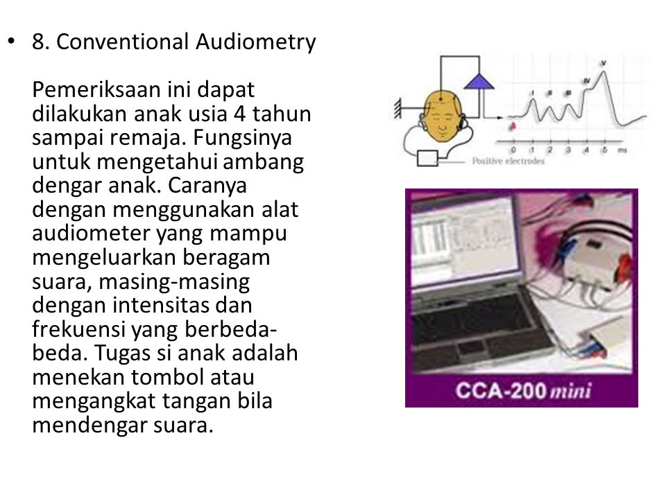 8. Conventional Audiometry Pemeriksaan ini dapat dilakukan anak usia 4 tahun sampai remaja.