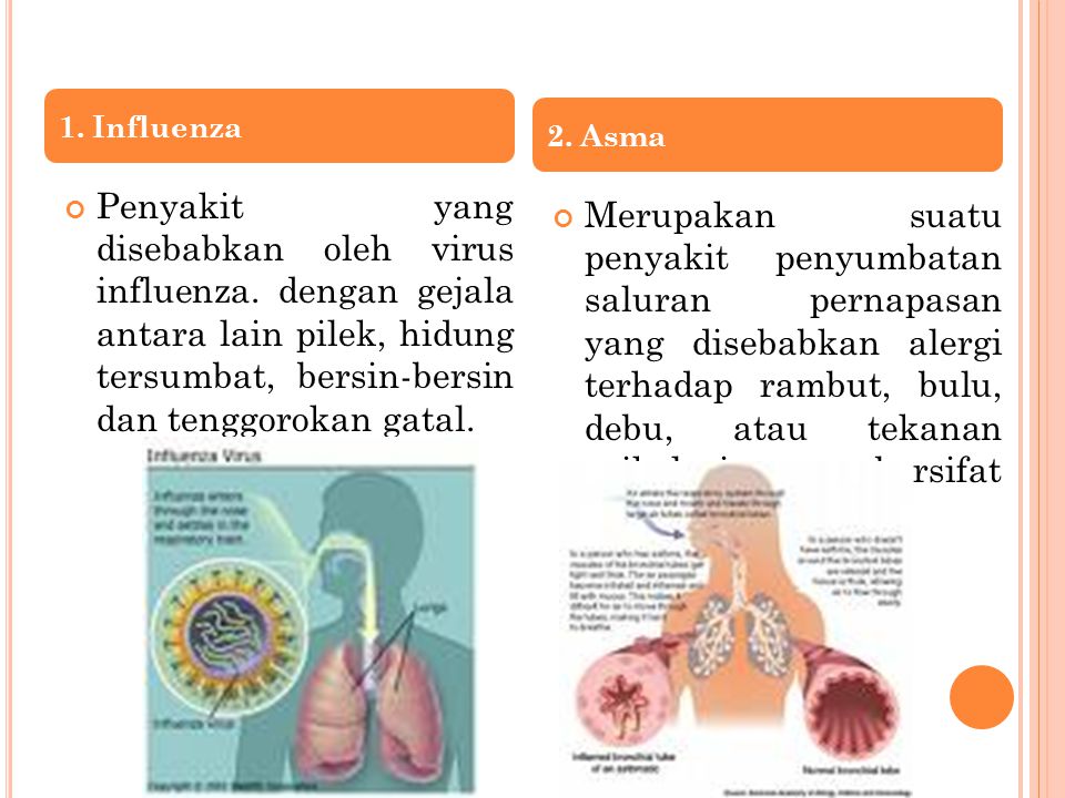 1. Influenza 2. Asma.