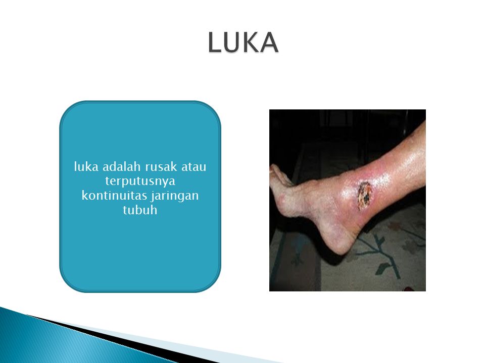 luka adalah rusak atau terputusnya kontinuitas jaringan tubuh