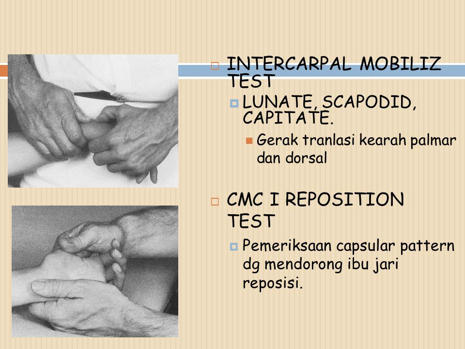 INTERCARPAL MOBILIZ TEST