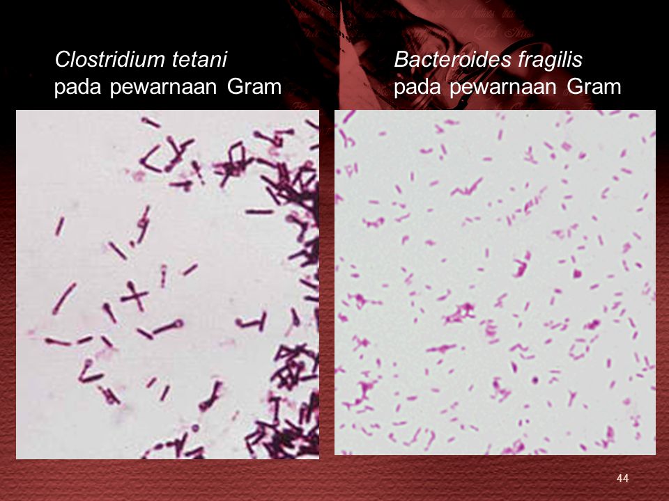 Dr Maya Savira M Kes Departemen Mikrobiologi Fakultas Kedokteran Ur Ppt Download