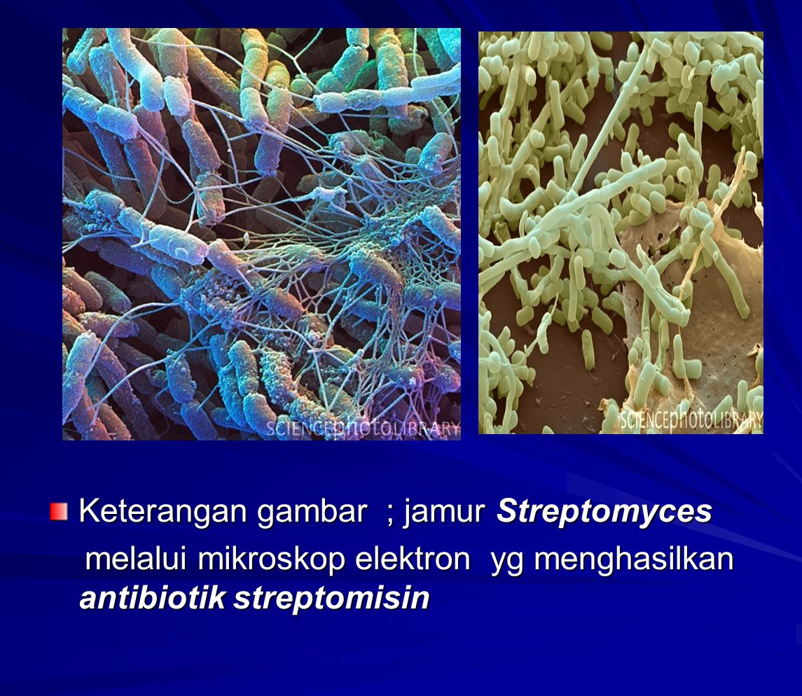 Keterangan gambar ; jamur Streptomyces