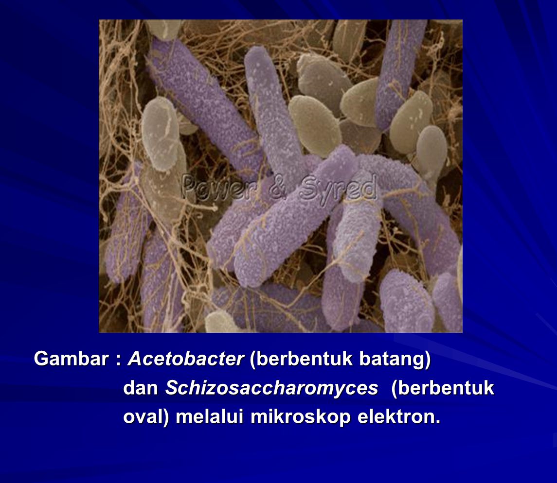 Gambar : Acetobacter (berbentuk batang)
